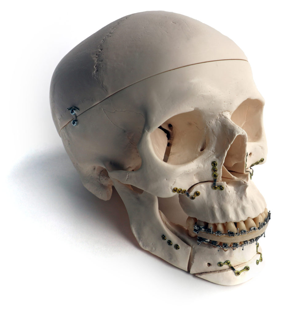 replica of a skull